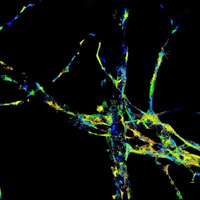 Trajectories of individual molecules of cholera toxin B-subunit binding to the plasma membrane of cultured neurons